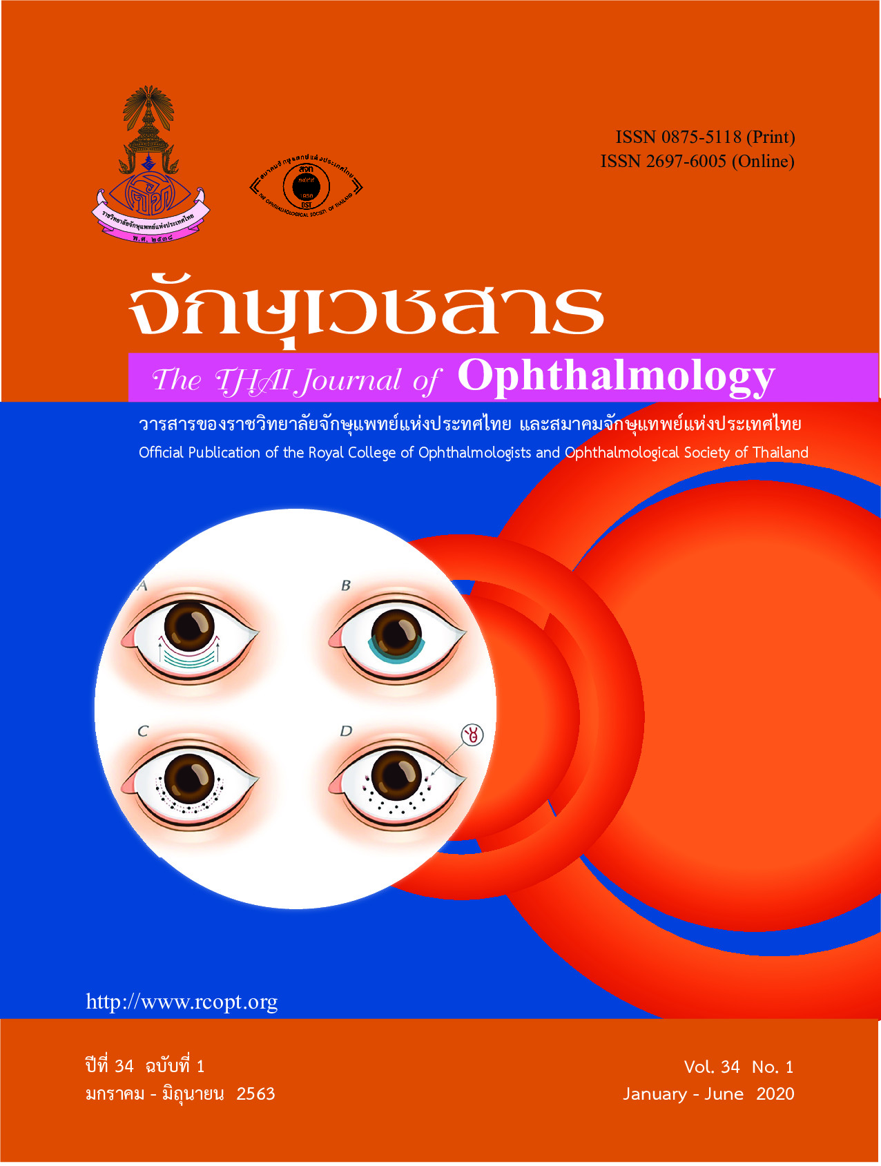 185900-cover J Ophthalmol-34-1.jpg